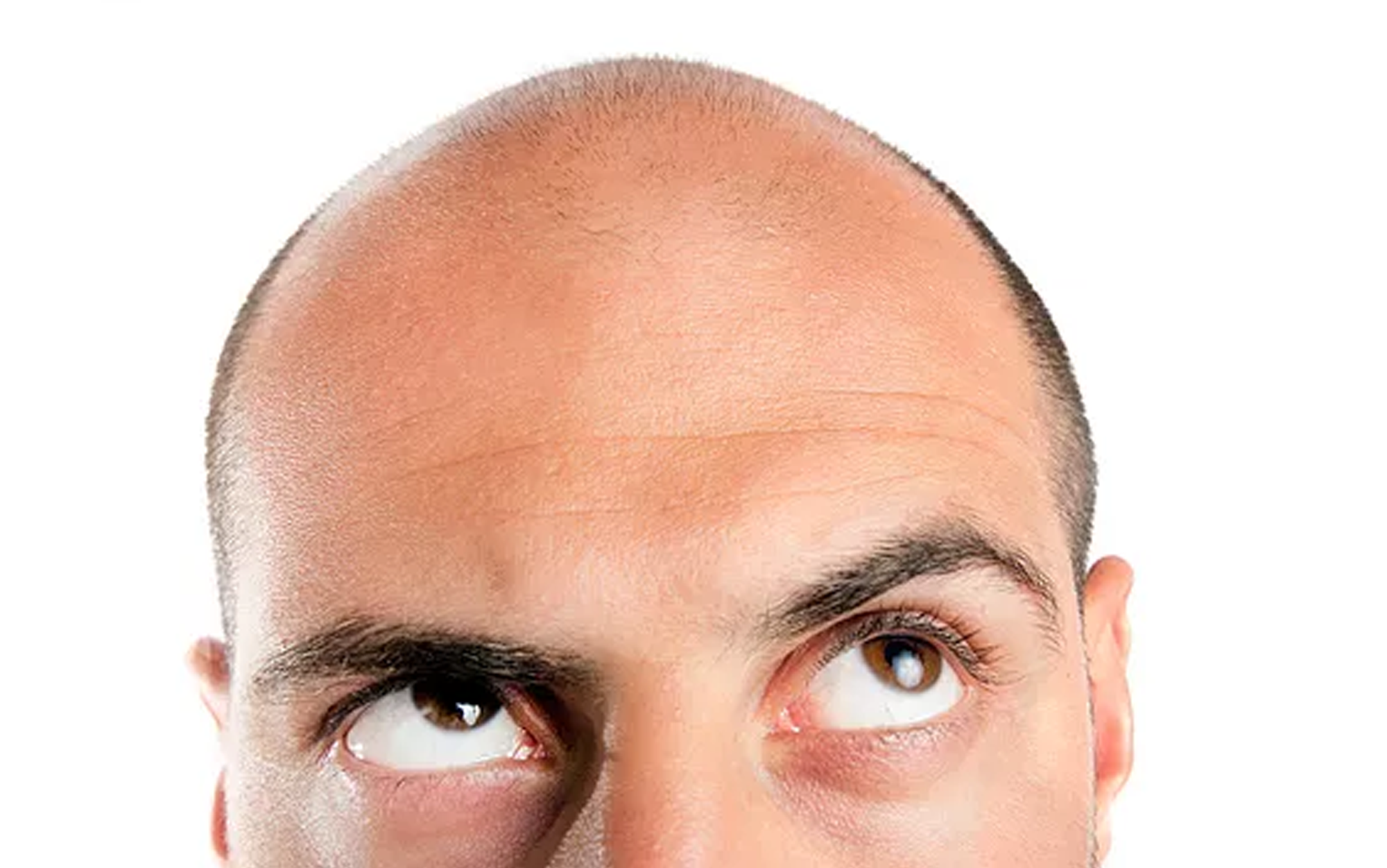 homme chauve complexe BYSIX