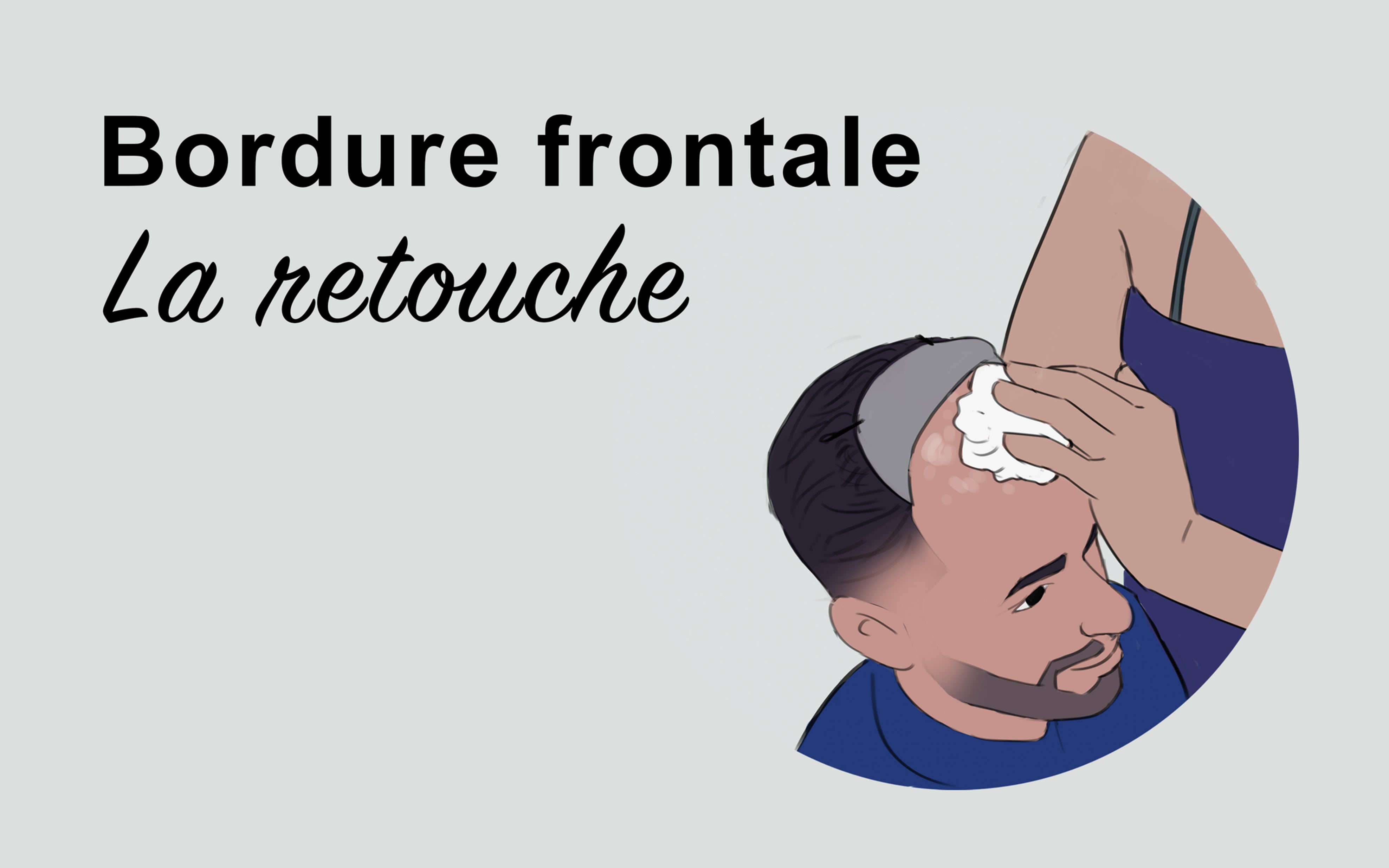 Retouche ligne frontale BYSIX